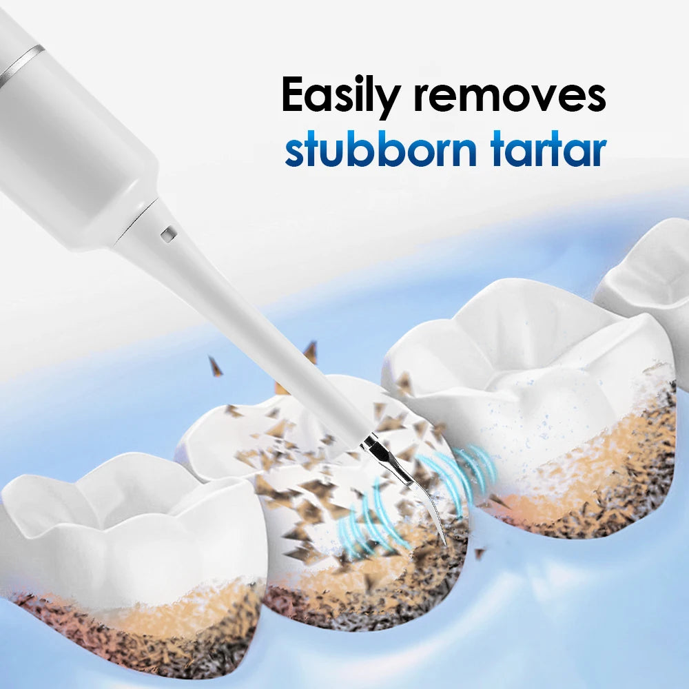 NeuroVibe™ Sonic Dental Tartar Remover & Teeth Cleaner